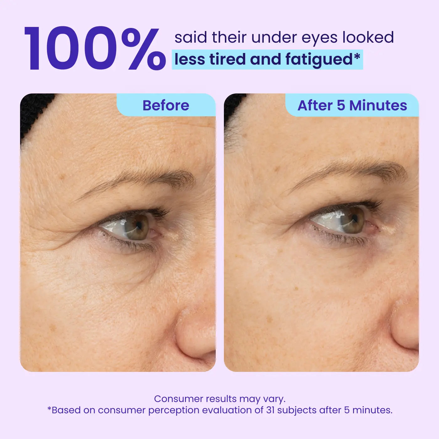 Final 3 Hours: 60%OFF🔥 Instant Lift Eye Gel for Puffiness, Bags & Dark Circles🔥