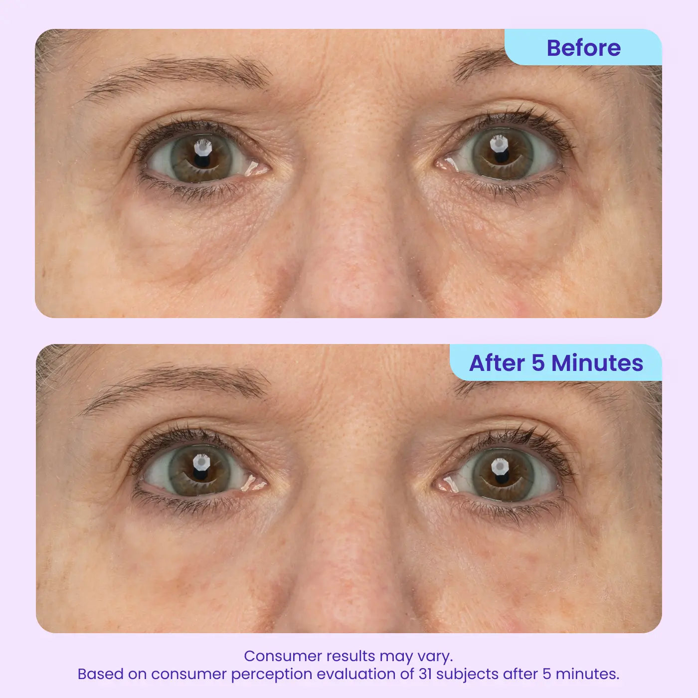 Final 3 Hours: 60%OFF🔥 Instant Lift Eye Gel for Puffiness, Bags & Dark Circles🔥