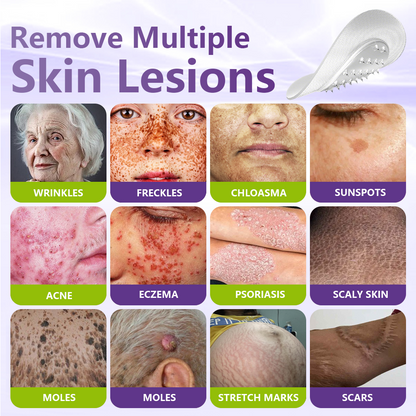 NESLEMY® Soluble Microneedle Botanical Skin Tag Removal Patch