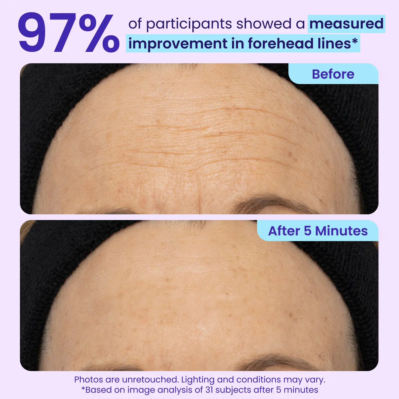 Final 3 Hours: 60%OFF🔥 Instant Lift Eye Gel for Puffiness, Bags & Dark Circles🔥