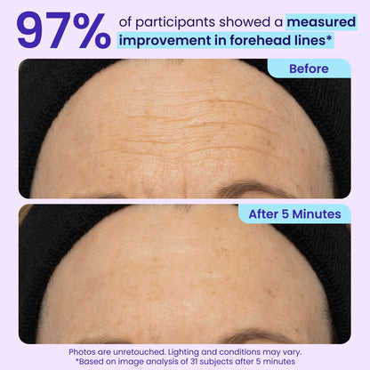 Final 3 Hours: 60%OFF🔥 Instant Lift Eye Gel for Puffiness, Bags & Dark Circles🔥
